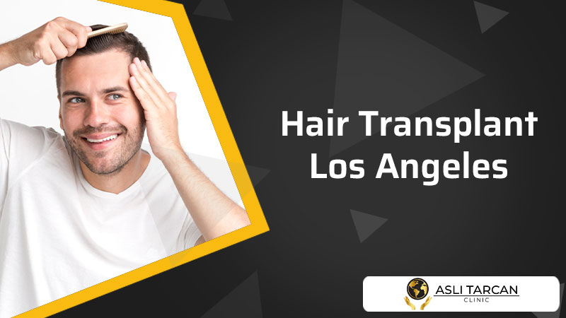 Hair Transplant Los Angeles