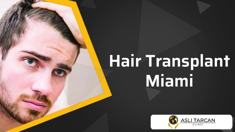 Hair Transplant Miami