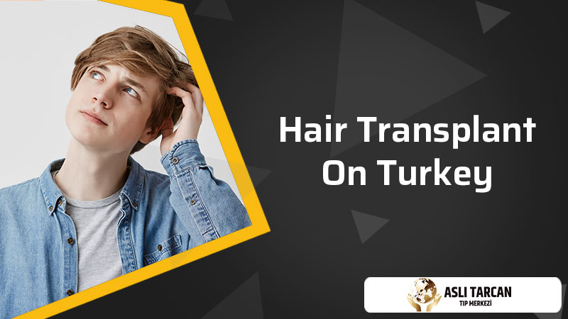 Hair Transplant on Turkey