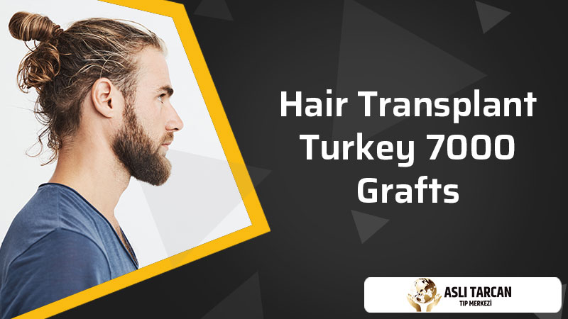 Hair Transplant Turkey 7000 Grafts | Asli Tarcan Clinic
