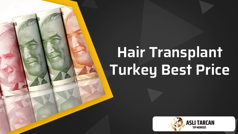 Hair Transplant Turkey Best Price