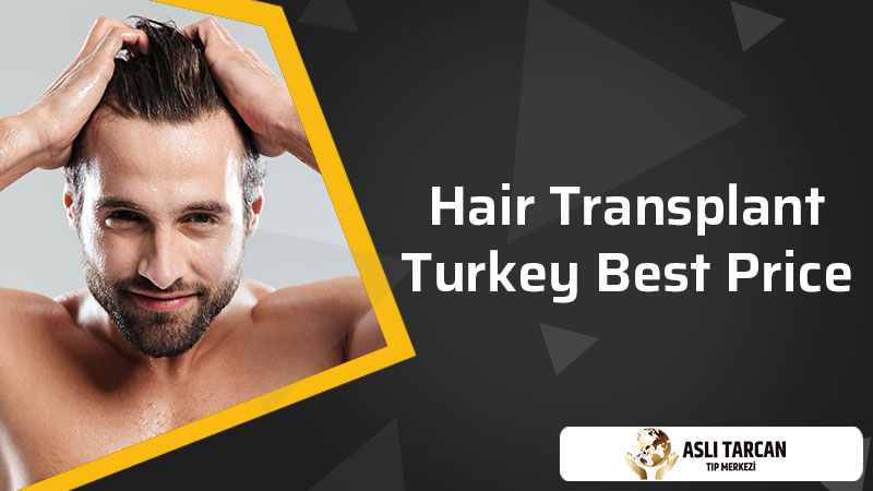 Top 7 Mistakes Hair Transplant Patients Do - Cyber Hairsure