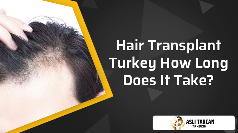 Hair Transplant Turkey How Long Does It Take?