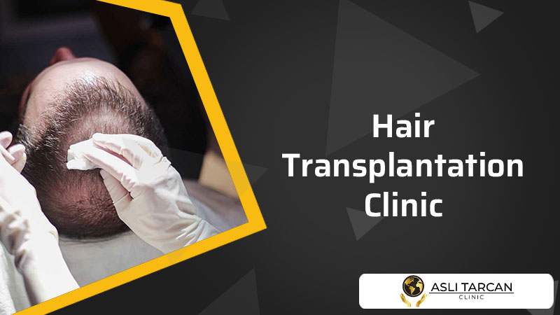 Hair Transplantation Clinic