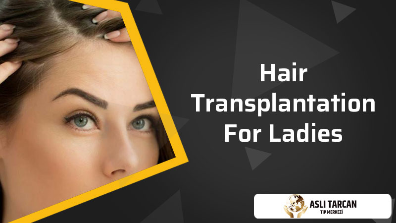 Hair Transplantation For Ladies