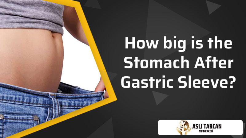 How Big Is The Stomach After Gastric Sleeve?