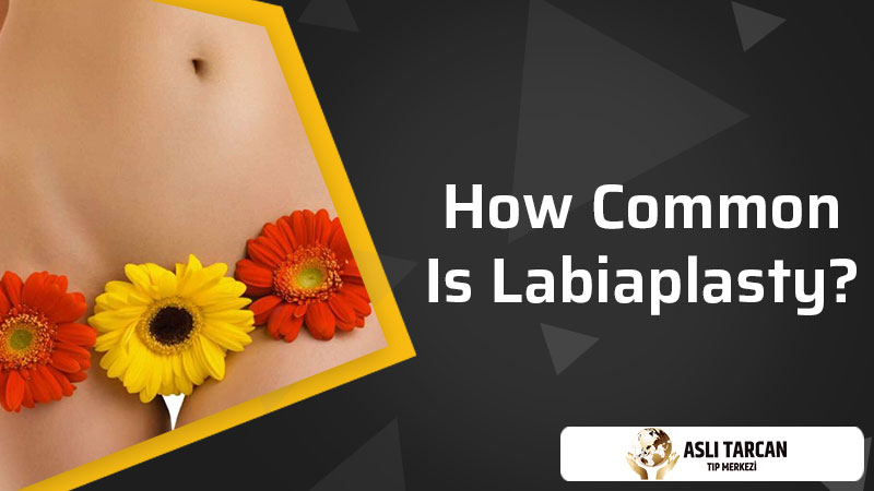 How Common Is Labiaplasty?