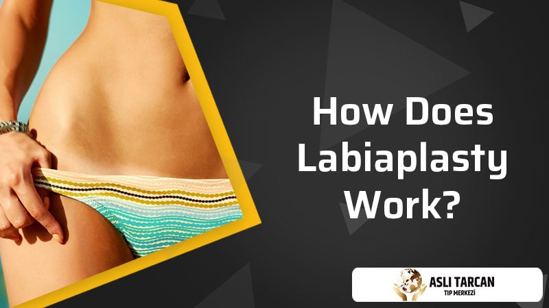 How Does Labiaplasty Work?