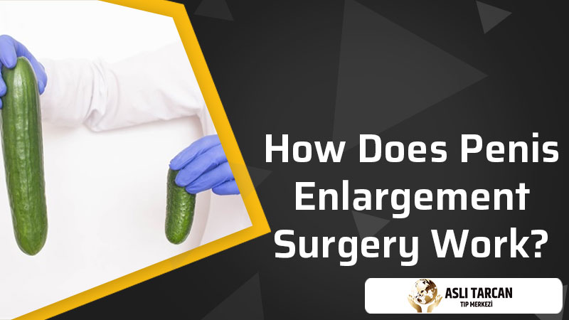 How Does Penis Enlargement Surgery Work?