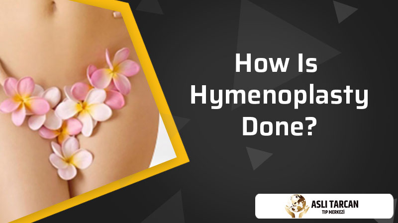 How Is Hymenoplasty Done?