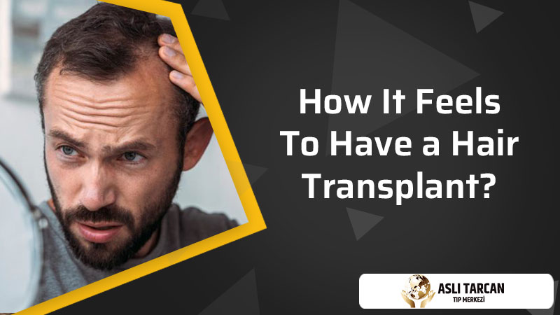 How It Feels To Have a Hair Transplant?