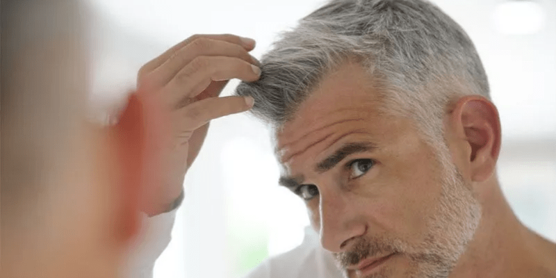 The How Long After Hair Transplant Will Hair Fall Out?