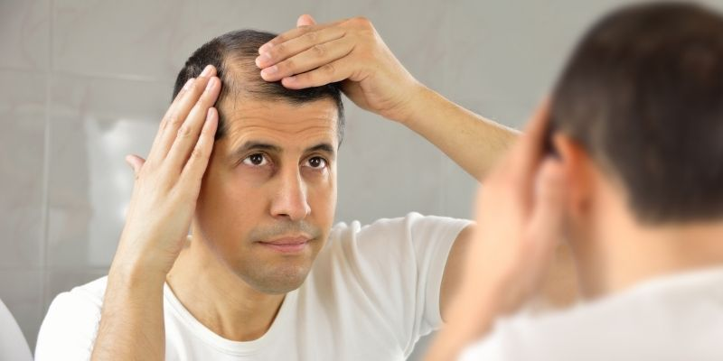 How Long Does A Hair Transplant Work?