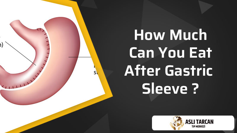 How Much Can You Eat After Gastric Sleeve