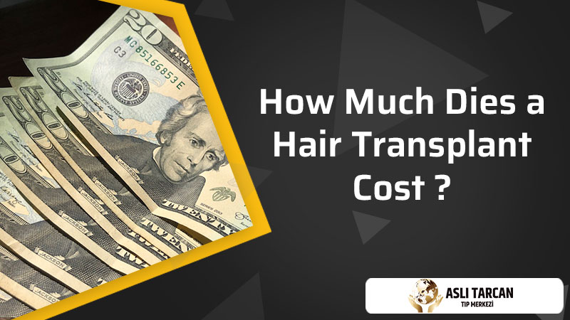 How Much Dies a Hair Transplant Cost