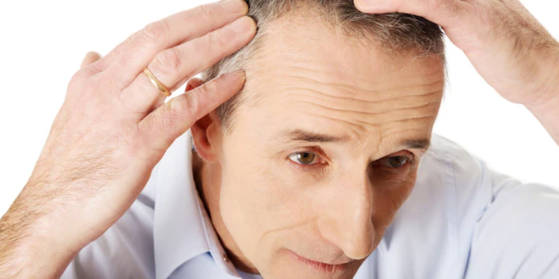 How much does FUE hair transplant cost