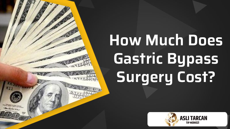 How Much Does Gastric Bypass Surgery Cost?
