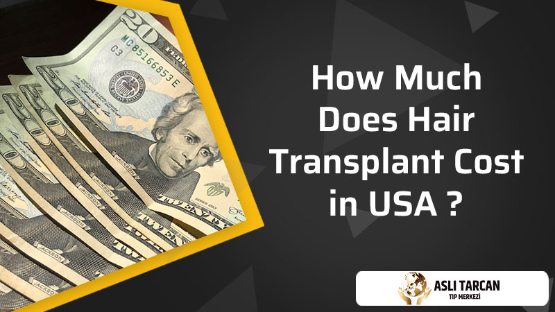 How Much Does Hair Transplant Cost in USA