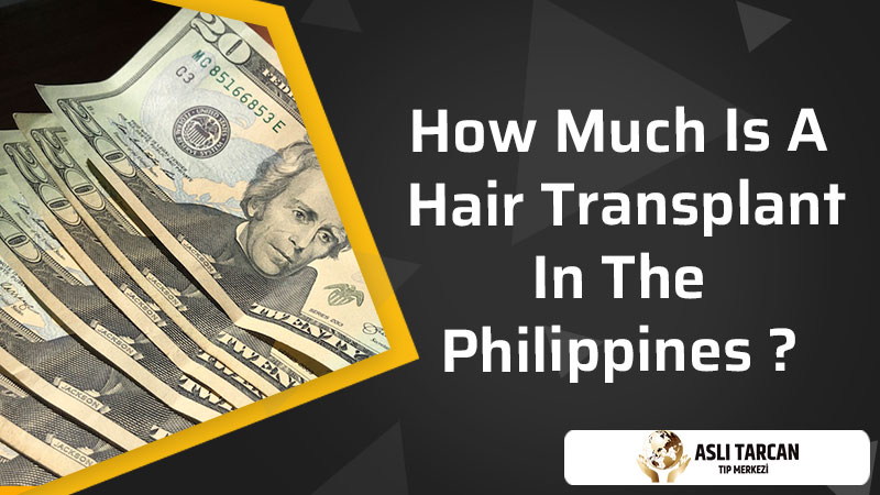 How Much Is A Hair Transplant In The Philippines