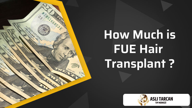How Much Is FUE Hair Transplant?