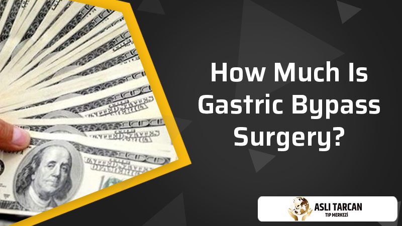 How Much Is Gastric Bypass Surgery?