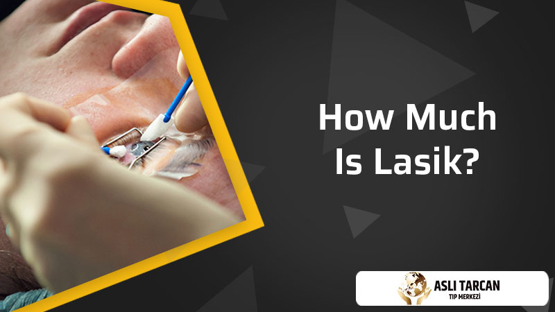 How Much Is Lasik?
