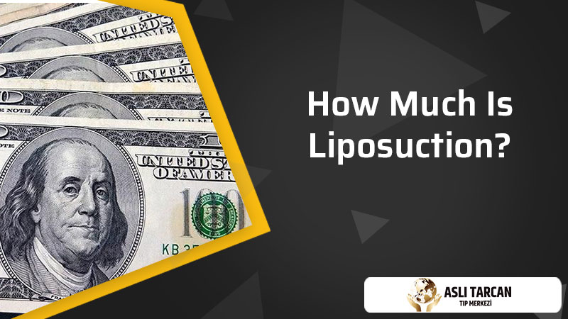 How Much Is Liposuction?