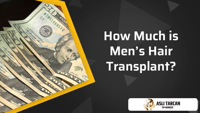 How Much is Men's Hair Transplant?