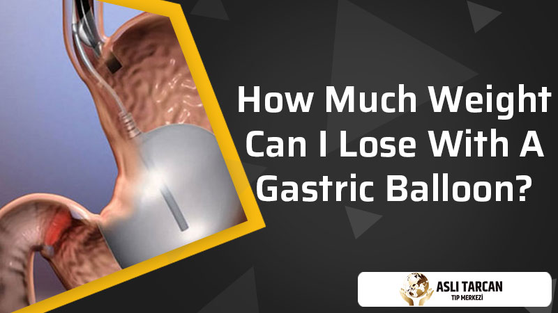 How Much Weight Can I Lose With A Gastric Balloon?