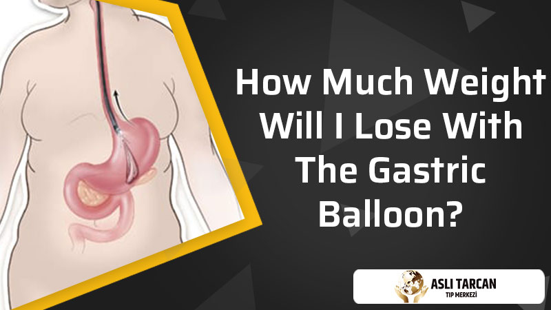 How Much Weight Will I Lose With The Gastric Balloon