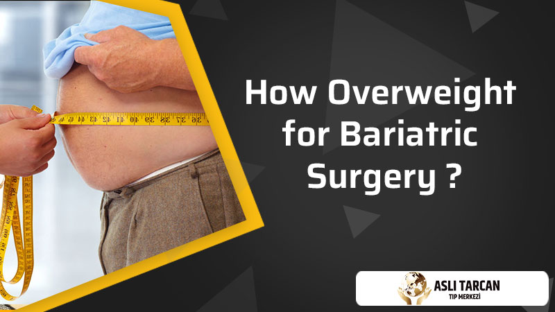 How Overweight for Bariatric Surgery