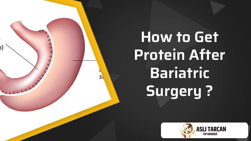 How to Get Protein After Bariatric Surgery