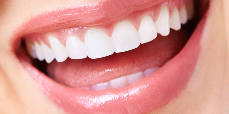 How To Get Ready For Dental Implants?