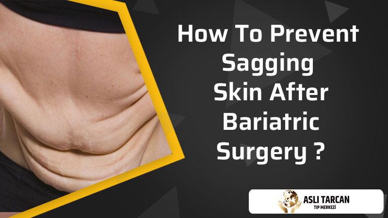 How To Prevent Sagging Skin After Bariatric Surgery