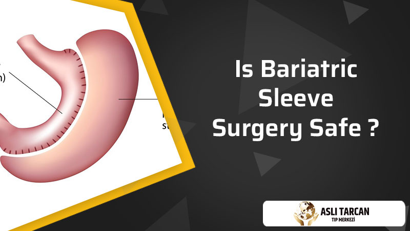 Is Bariatric Sleeve Surgery Safe