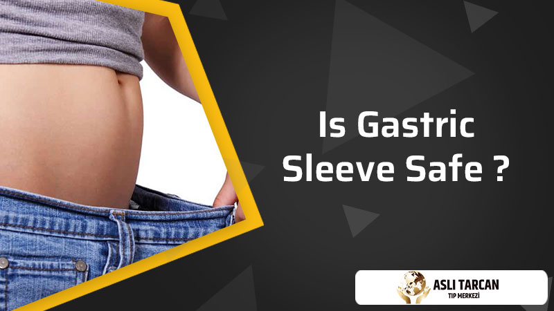 Is Gastric Sleeve Safe