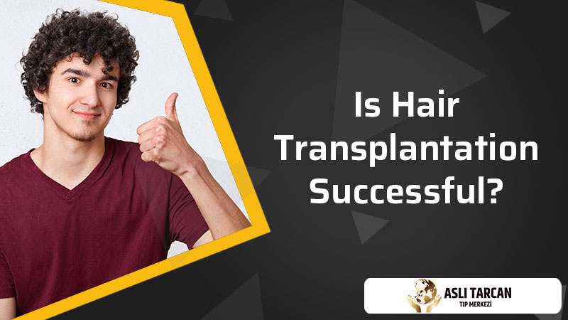 Is Hair Transplantation Successful?