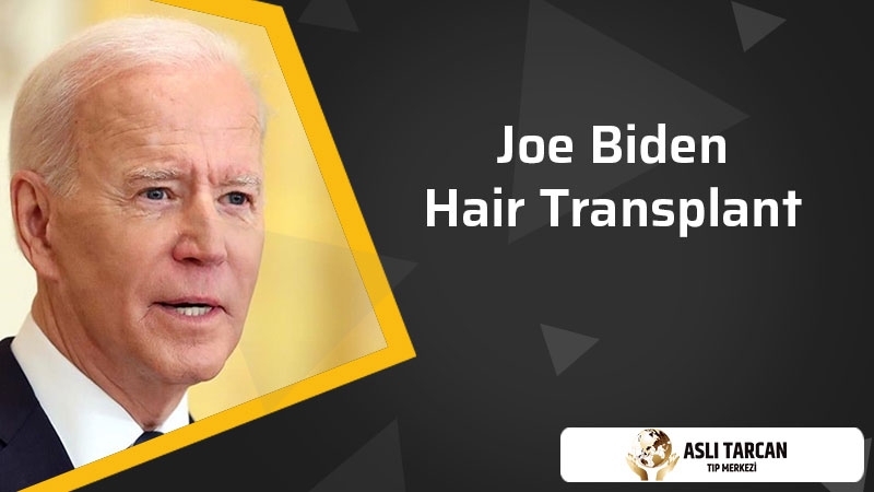 Joe Biden Hair Transplant 