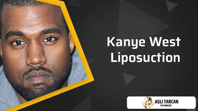 Kanye West Liposuction