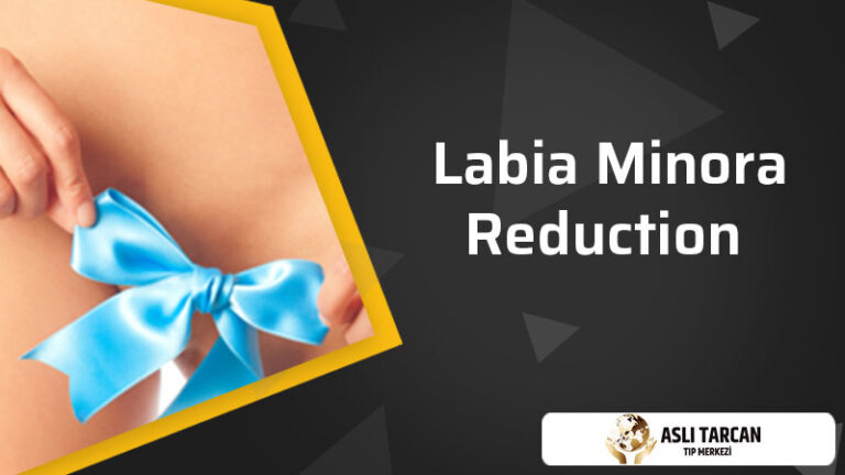Labia Minora Reduction