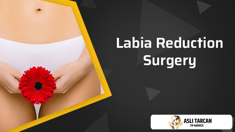 Labia Reduction Surgery