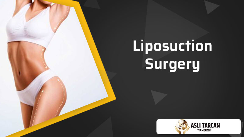 Liposuction Surgery