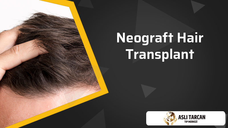 Neograft Hair Transplant | Asli Tarcan Clinic