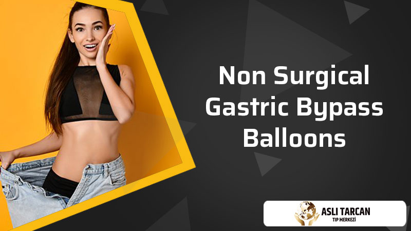 Non Surgical Gastric Bypass Balloons