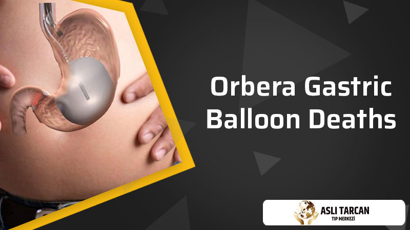 Orbera Gastric Balloon deaths