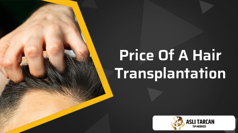 price of a hair transplantation?