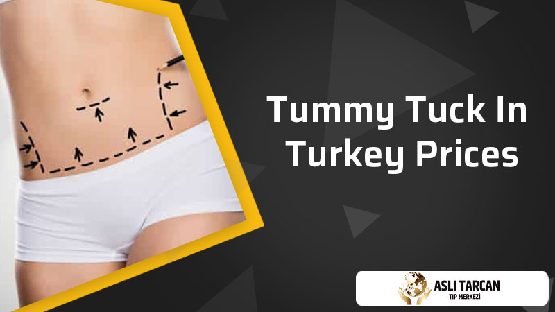 Tummy Tuck In Turkey Prices