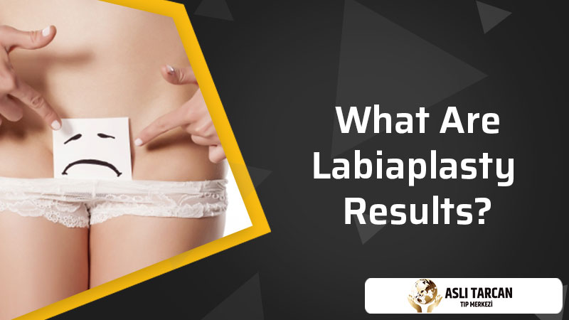 What Are Labiaplasty Results?