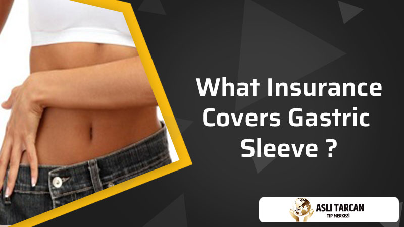 What Insurance Covers Gastric Sleeve