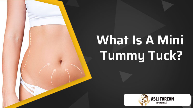 What Is Mini Tummy Tuck?